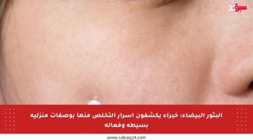 البثور البيضاء: خبراء يكشفون أسرار التخلص منها بوصفات منزلية بسيطة وفعالة